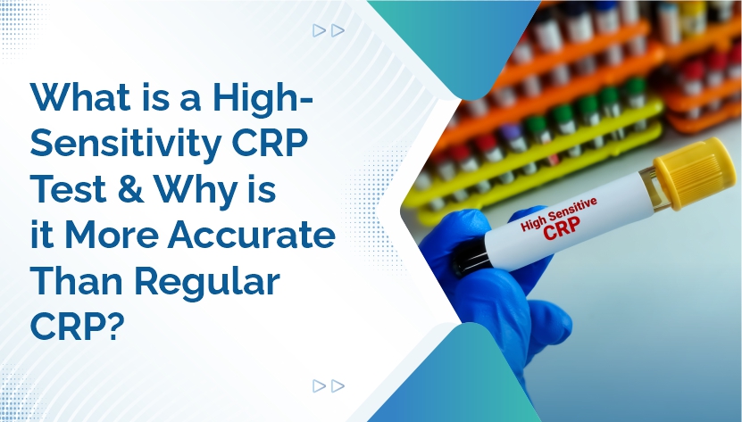 What Is a High-Sensitivity CRP Test and Why Is It More Accurate Than Regular  CRP?